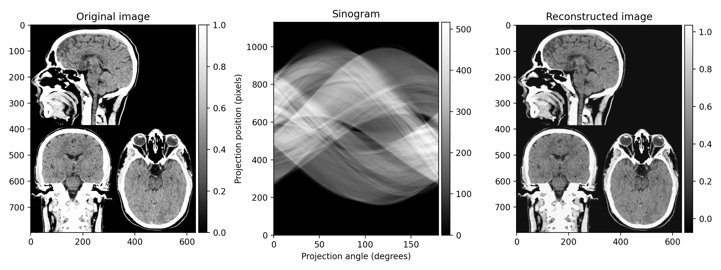 The Radon transform and reconstruction