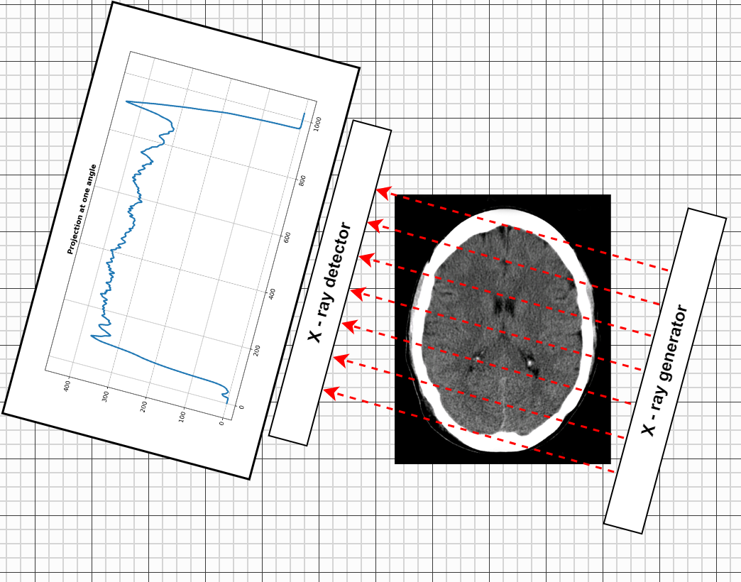 The Radon transform and reconstruction